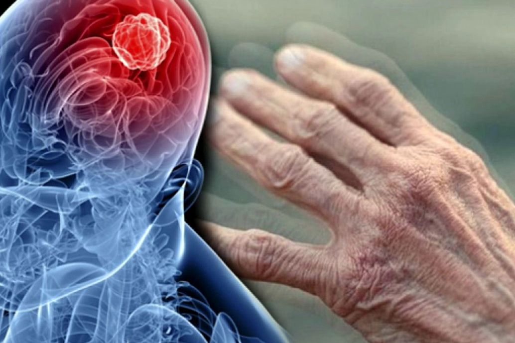 Tarım ila&ccedil;ları parkinson riskini artırabilir